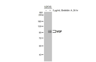 Anti-VGF antibody [HL6160] used in Western Blot (WB). GTX648247
