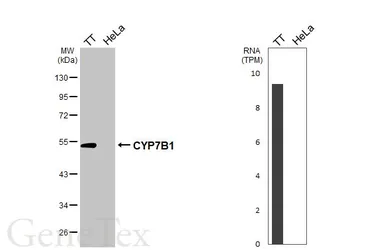 Anti-CYP7B1 antibody [HL6162] used in Western Blot (WB). GTX648249