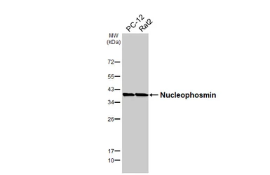 Anti-Nucleophosmin antibody [HL6166] used in Western Blot (WB). GTX648253
