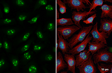Anti-Nucleophosmin antibody [HL6166] used in Immunocytochemistry/ Immunofluorescence (ICC/IF). GTX648253