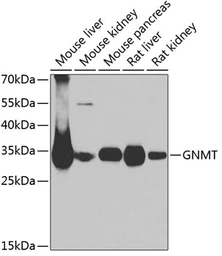 Anti-GNMT antibody used in Western Blot (WB). GTX64826
