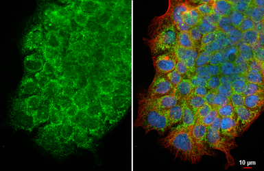 Anti-CD2AP antibody [HL6174] used in Immunocytochemistry/ Immunofluorescence (ICC/IF). GTX648261