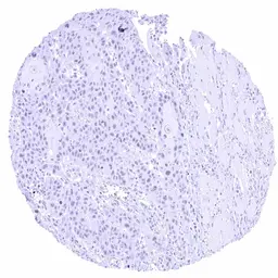Anti-FOXA1 antibody [HMV4726] HistoMAX&trade; used in IHC (Paraffin sections) (IHC-P). GTX648263