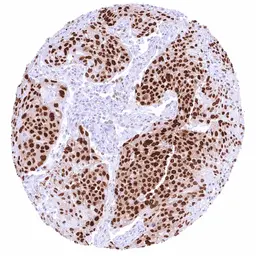 Anti-FOXA1 antibody [HMV4726] HistoMAX&trade; used in IHC (Paraffin sections) (IHC-P). GTX648263
