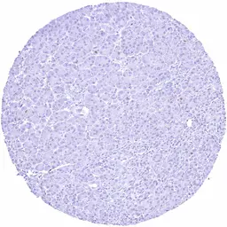 Anti-Rad51 antibody [HMV4727] HistoMAX&trade; used in IHC (Paraffin sections) (IHC-P). GTX648264