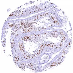 Anti-Rad51 antibody [HMV4727] HistoMAX&trade; used in IHC (Paraffin sections) (IHC-P). GTX648264