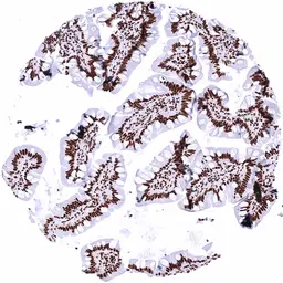 Anti-PUF60 antibody [HMV4728] HistoMAX&trade; used in IHC (Paraffin sections) (IHC-P). GTX648265