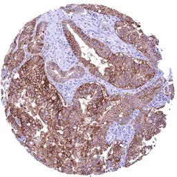 Anti-Claudin 18.2 antibody [HMV4729] HistoMAX&trade; used in IHC (Paraffin sections) (IHC-P). GTX648266