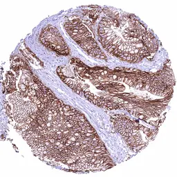 Anti-Claudin 18.2 antibody [HMV4729] HistoMAX&trade; used in IHC (Paraffin sections) (IHC-P). GTX648266