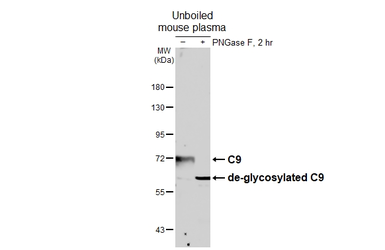 Anti-C9 antibody [HL6178] used in Western Blot (WB). GTX648270