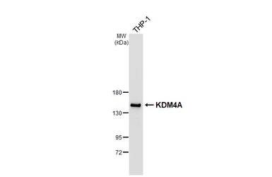 Anti-KDM4A antibody [HL6180] used in Western Blot (WB). GTX648272