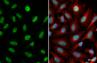 Anti-KDM4A antibody [HL6181] used in Immunocytochemistry/ Immunofluorescence (ICC/IF). GTX648273
