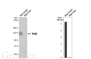 Anti-TrkB antibody [HL6182] used in Western Blot (WB). GTX648274