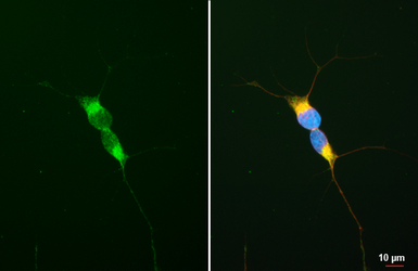 Anti-TrkB antibody [HL6182] used in Immunocytochemistry/ Immunofluorescence (ICC/IF). GTX648274