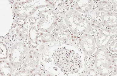Anti-Retinoid X Receptor alpha antibody [HL6191] used in IHC (Paraffin sections) (IHC-P). GTX648283