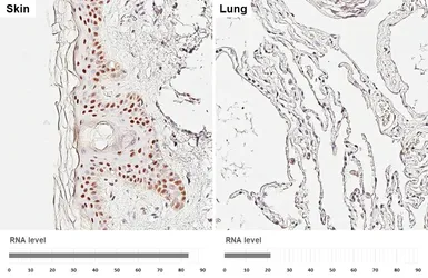 Anti-Retinoid X Receptor alpha antibody [HL6191] used in IHC (Paraffin sections) (IHC-P). GTX648283