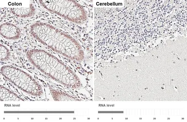 Anti-Retinoid X Receptor alpha antibody [HL6191] used in IHC (Paraffin sections) (IHC-P). GTX648283