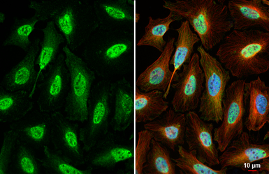 Anti-Retinoid X Receptor alpha antibody [HL6191] used in Immunocytochemistry/ Immunofluorescence (ICC/IF). GTX648283