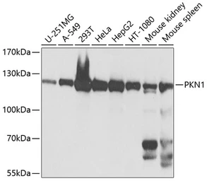 Anti-PKN1 antibody used in Western Blot (WB). GTX64829