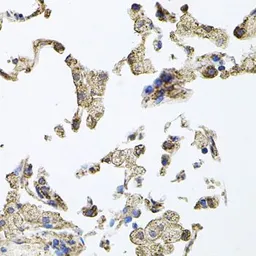 Anti-PKN1 antibody used in IHC (Paraffin sections) (IHC-P). GTX64829