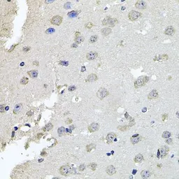 Anti-PKN1 antibody used in IHC (Paraffin sections) (IHC-P). GTX64829