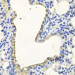Anti-PKN1 antibody used in IHC (Paraffin sections) (IHC-P). GTX64829