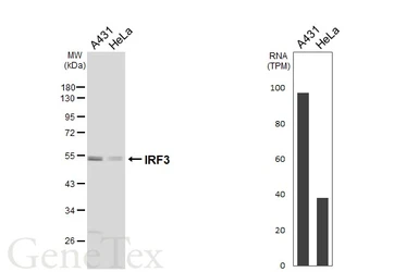 Anti-IRF3 antibody [HL6200] used in Western Blot (WB). GTX648292