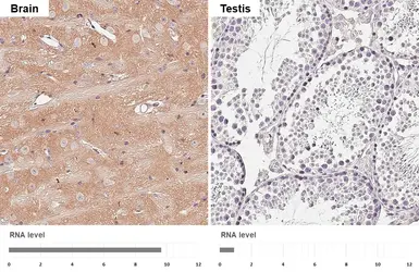 Anti-ROCK2 antibody [HL6209] used in IHC (Paraffin sections) (IHC-P). GTX648301