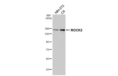 Anti-ROCK2 antibody [HL6209] used in Western Blot (WB). GTX648301
