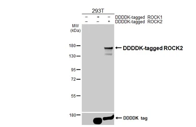 Anti-ROCK2 antibody [HL6209] used in Western Blot (WB). GTX648301