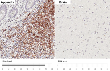 Anti-CD20 antibody [HL6219] used in IHC (Paraffin sections) (IHC-P). GTX648311