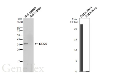Anti-CD20 antibody [HL6219] used in Western Blot (WB). GTX648311