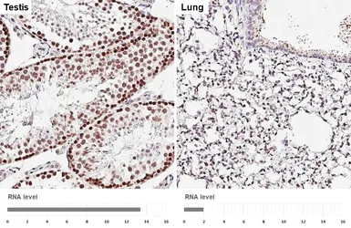 Anti-FEN1 antibody [HL6226] used in IHC (Paraffin sections) (IHC-P). GTX648318