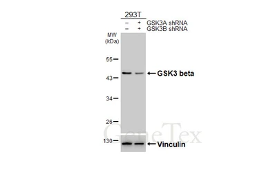 Anti-GSK3 beta antibody [HL6229] used in Western Blot (WB). GTX648321
