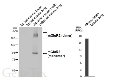 Anti-mGluR2 antibody [HL6234] used in Western Blot (WB). GTX648326