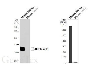 Anti-Aldolase B antibody [HL6236] used in Western Blot (WB). GTX648328