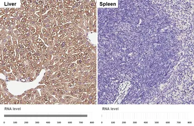 Anti-Aldolase B antibody [HL6236] used in IHC (Paraffin sections) (IHC-P). GTX648328