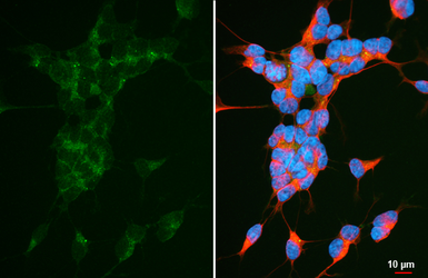 Anti-Aldolase B antibody [HL6236] used in Immunocytochemistry/ Immunofluorescence (ICC/IF). GTX648328