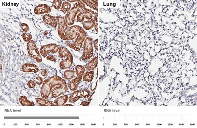 Anti-Aldolase B antibody [HL6238] used in IHC (Paraffin sections) (IHC-P). GTX648330