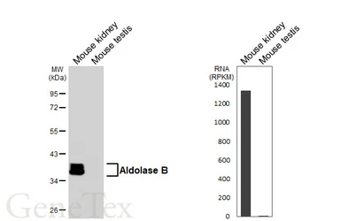 Anti-Aldolase B antibody [HL6238] used in Western Blot (WB). GTX648330
