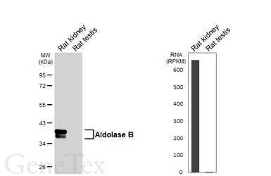 Anti-Aldolase B antibody [HL6238] used in Western Blot (WB). GTX648330