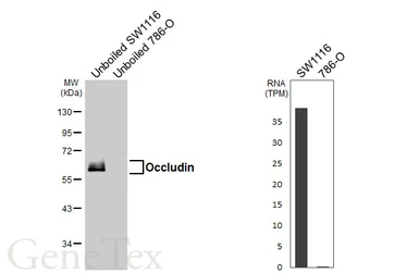 Anti-Occludin antibody [HL6239] used in Western Blot (WB). GTX648331