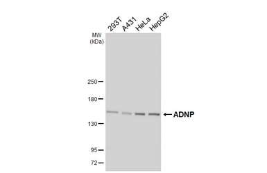 Anti-ADNP antibody [HL6241] used in Western Blot (WB). GTX648333