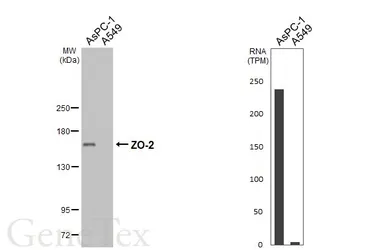 Anti-ZO-2 antibody [HL6245] used in Western Blot (WB). GTX648337