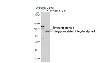 Anti-Integrin alpha 4 antibody [HL6249] used in Western Blot (WB). GTX648341