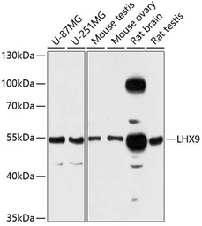 Anti-LHX9 antibody used in Western Blot (WB). GTX64835