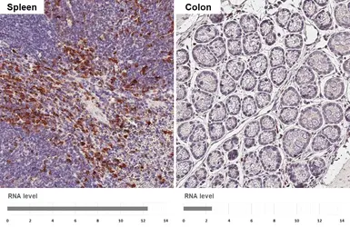 Anti-S100A4 antibody [HL6258] used in IHC (Paraffin sections) (IHC-P). GTX648350