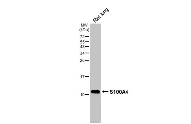 Anti-S100A4 antibody [HL6258] used in Western Blot (WB). GTX648350