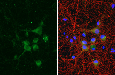 Anti-S100A4 antibody [HL6259] used in Immunocytochemistry/ Immunofluorescence (ICC/IF). GTX648351