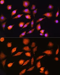 Anti-EXT2 antibody used in Immunocytochemistry/ Immunofluorescence (ICC/IF). GTX64836